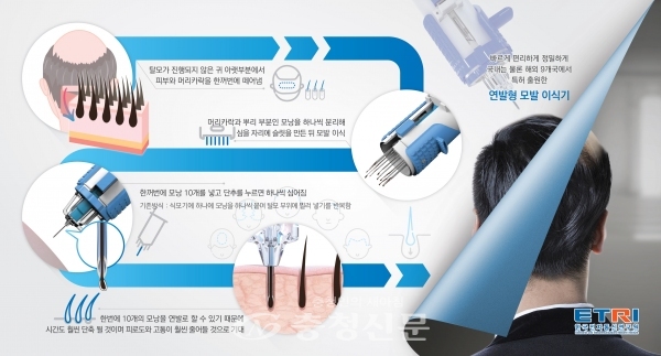 한국전자통신연구원(ETRI)는 경북대학교 모발이식센터, ㈜오대금속과 공동연구를 통해 수술시간을 30~50% 이상 단축시킬 수 있는 연발형 식모기(植毛機)를 개발했다고 밝혔다. (사진=ETRI)